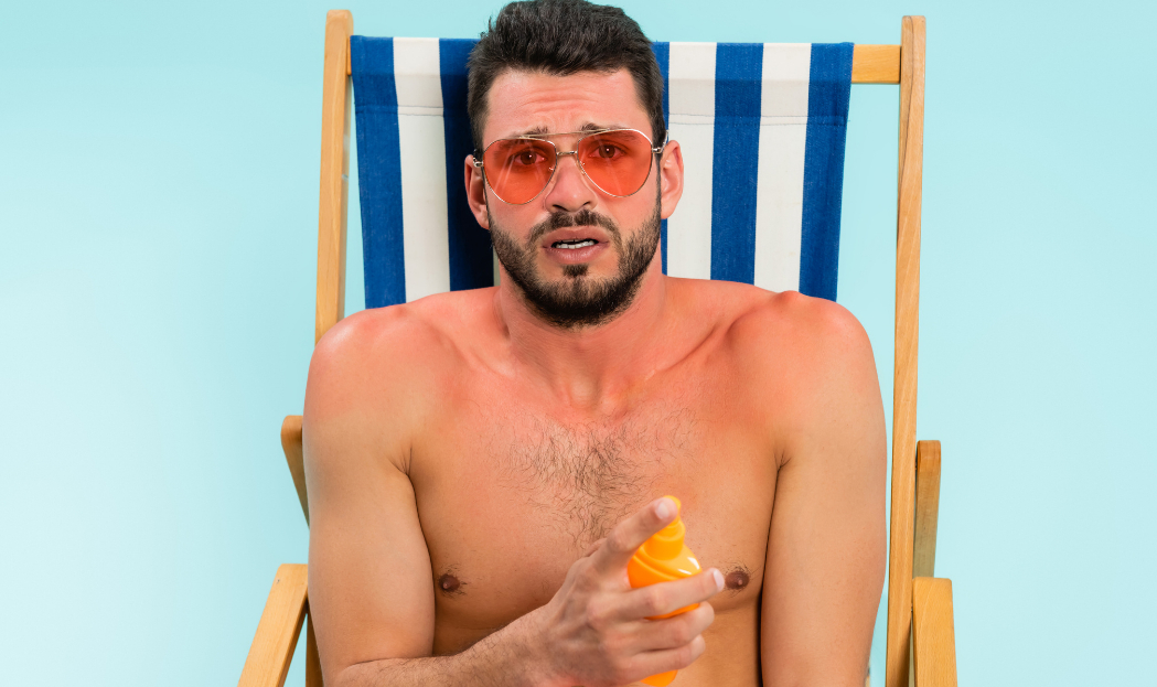 Scottature: come trattarle e prevenirle